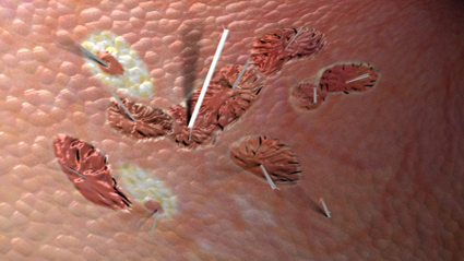 3-D representation of Asbestos particles and how they damage lungs. Video produced by award-winning WorkSafeBC. 